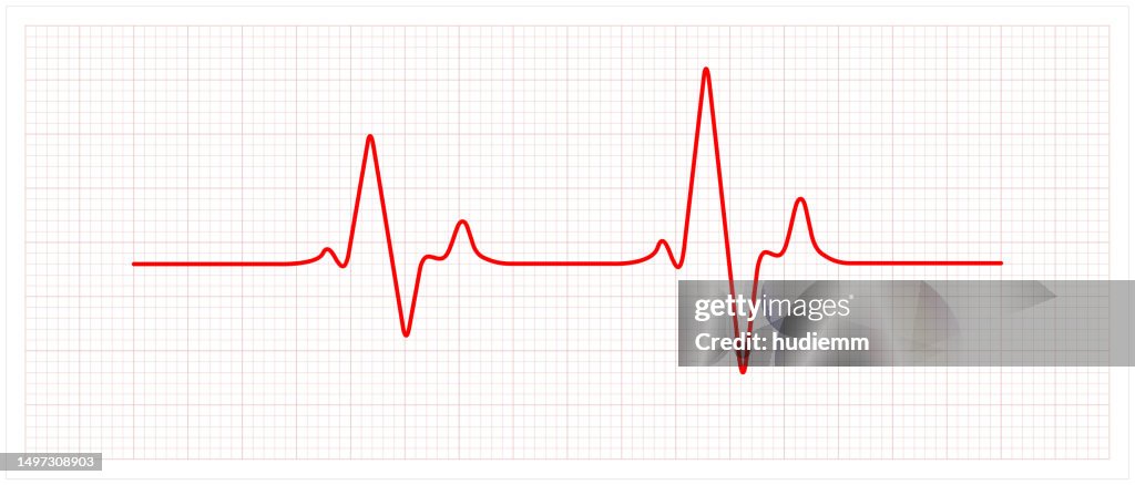 Vector electrocardiogram and heart pattern (health concept)
