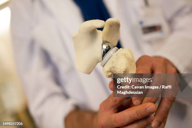 a surgeon holds a plastic shoulder to explain surgery to patients - human spine stock pictures, royalty-free photos & images