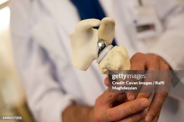 a surgeon holds a plastic shoulder to explain surgery to patients - tendon stock pictures, royalty-free photos & images