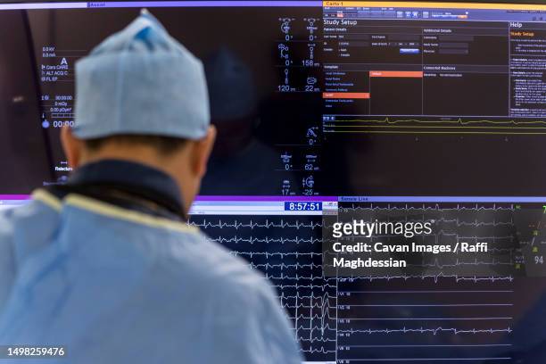 an angiologist sits in front of a screen showing a patient's heartbeat - angiogram stock pictures, royalty-free photos & images