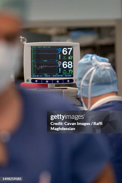 heart rate on a screen, in the operating room - critical care stock pictures, royalty-free photos & images