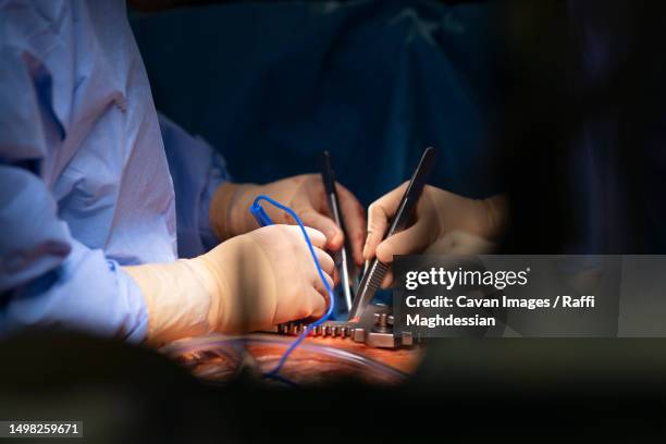 hands of surgeons during cardiovascular surgery - cavan images stockfoto's en -beelden