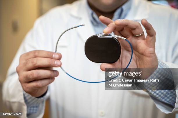a doctor shows a pacemaker - herzschrittmacher stock-fotos und bilder