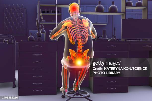 sitting man with coccyx pain, conceptual illustration - occupational health stock-grafiken, -clipart, -cartoons und -symbole