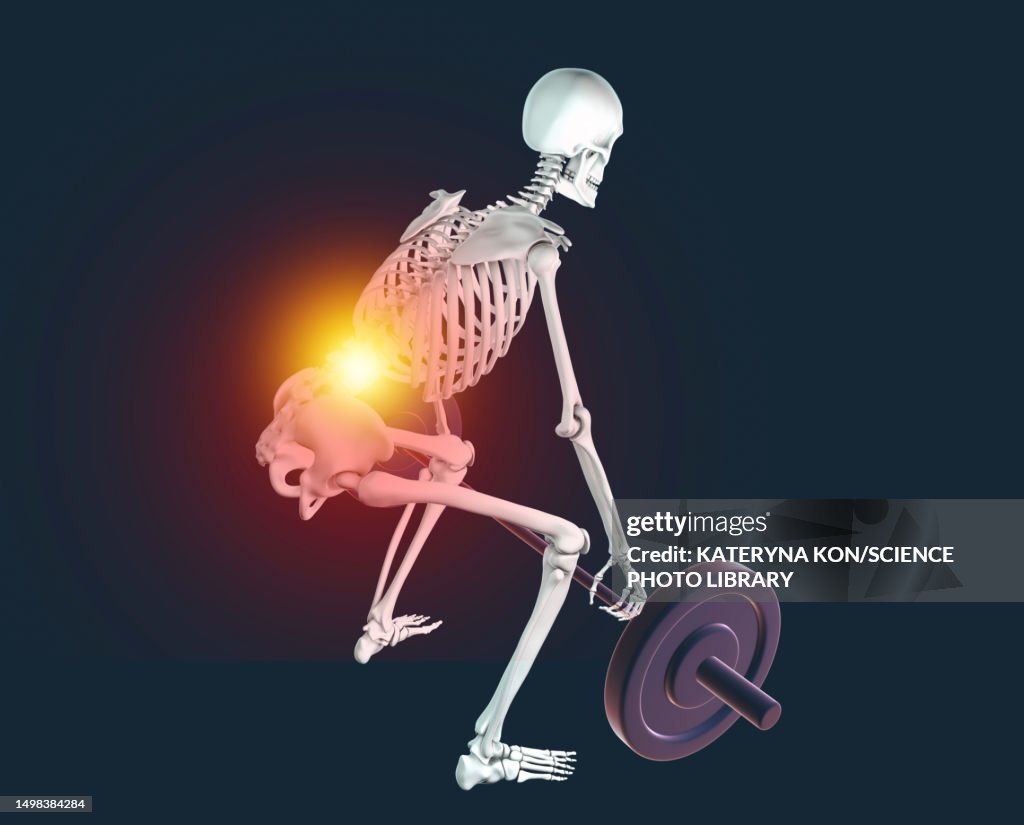Skeleton with back pain lifting a barbell, illustration
