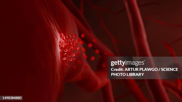 haemorrhage, illustration - hemorrhage stock illustrations