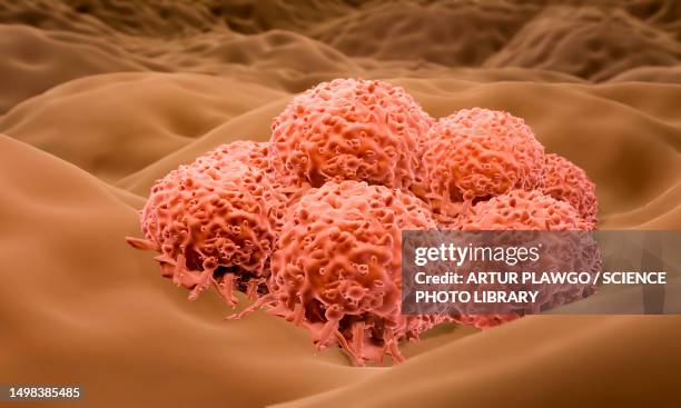 ilustraciones, imágenes clip art, dibujos animados e iconos de stock de melanoma cells, illustration - melanoma