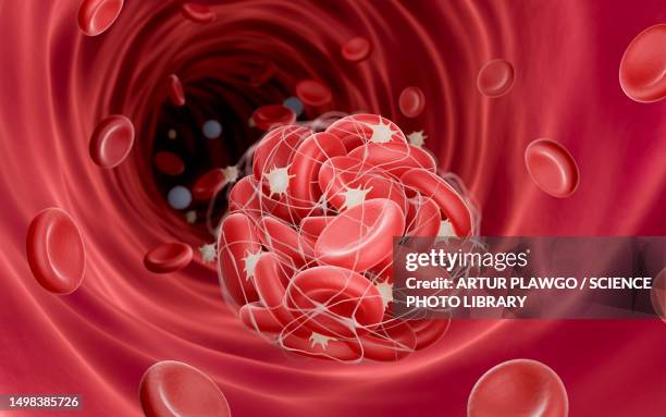 blood clot, illustration - coronary artery点のイラスト素材／クリップアート素材／マンガ素材／アイコン素材