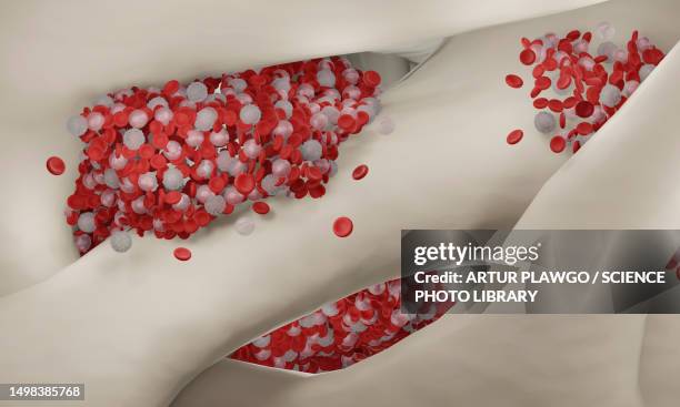 stockillustraties, clipart, cartoons en iconen met bone marrow, illustration - regenerative medicine