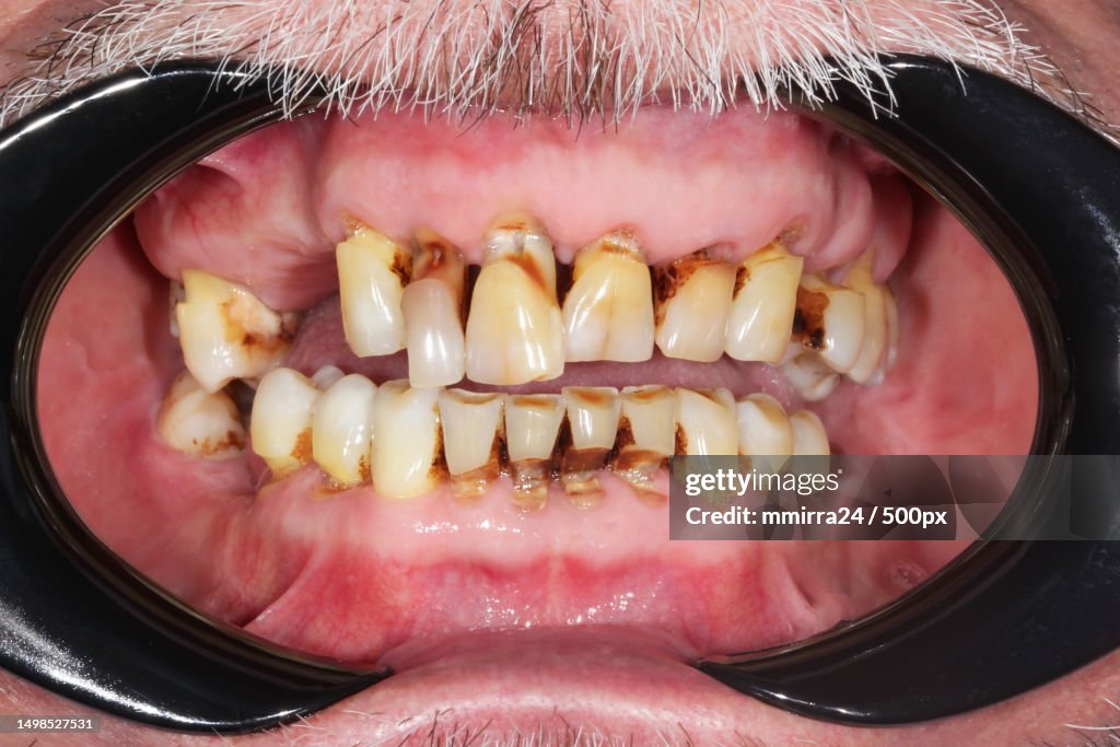 Close-up of man with mouth open