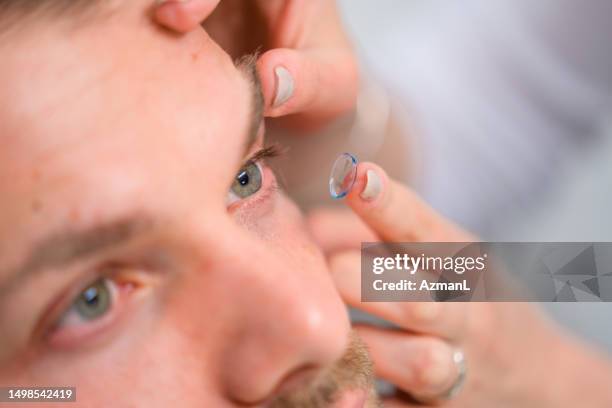 primo piano del paziente dell'occhio verde che ottiene le sue lenti a contatto - lenti a contatto foto e immagini stock