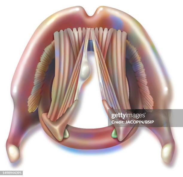 vocal cord polyp drawing - polyp stock illustrations
