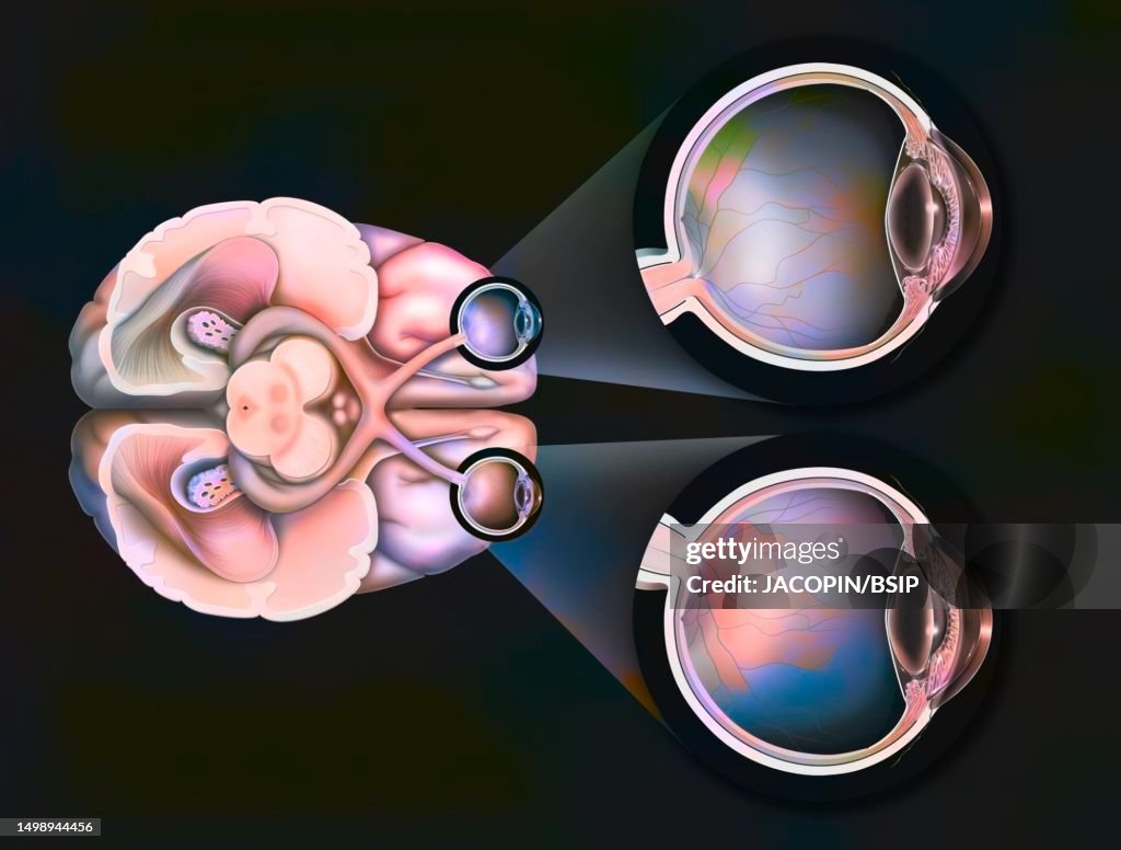 Examples Different Vision Images Meaning Of Vision High-Res Vector Graphic - Getty Images