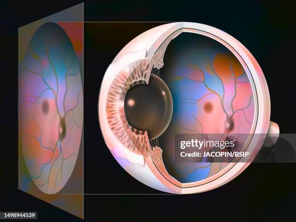 glaucoma drawing - glaucoma 幅插畫檔、美工圖案、卡通及圖標