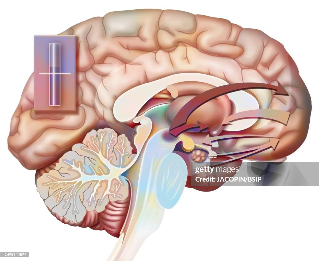 Brain drawing