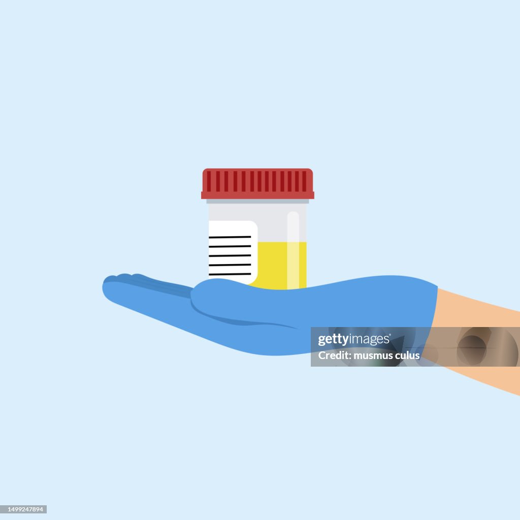 Laboratory analysis of urine