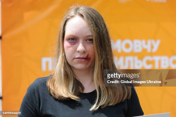 Woman with makeup on her face in the form of cuts and bruises typical of victims of domestic or sexual violence during the "Break The Silence" street...