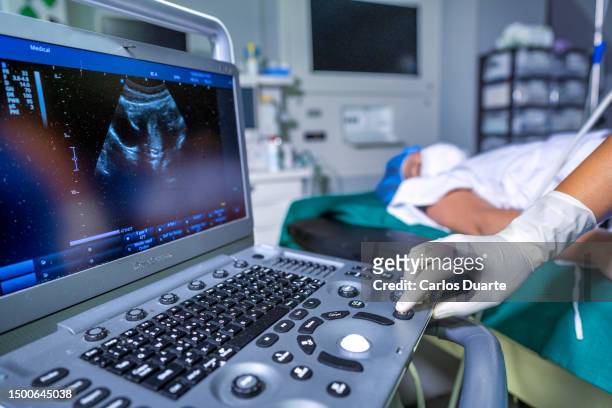 gynecologist doctor working with endometrial ultrasound scanning - 卵巣癌 ストックフォトと画像