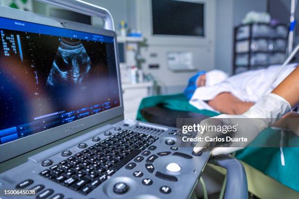 gynecologist doctor working with endometrial ultrasound scanning - ovarian cyst imagens e fotografias de stock