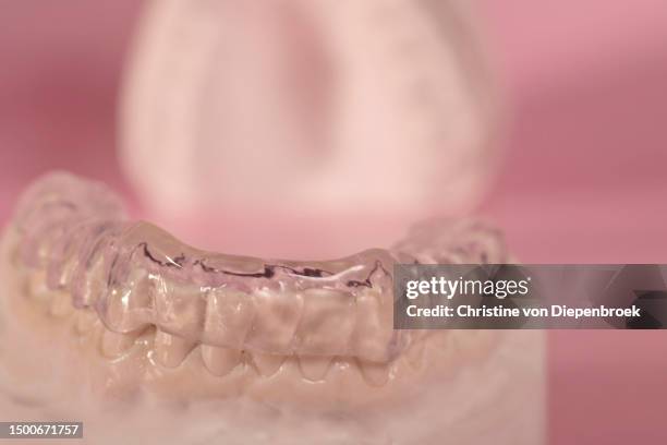 bruxism protection splint vor night - bruxism stock pictures, royalty-free photos & images