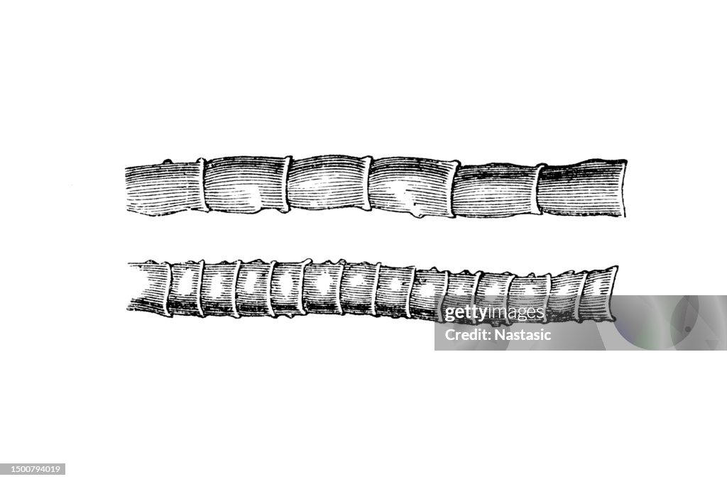 Semi-mature and mature limbs of Taenia solium