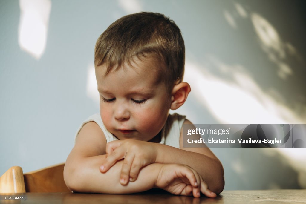 Child a scratching a mosquito bite