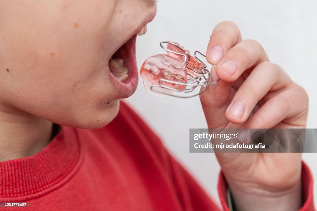 Boy holding orthodontic braces
