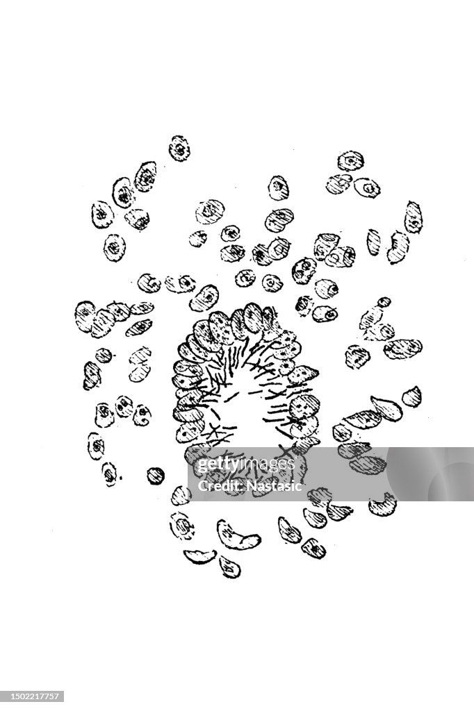 Cellula gigante del tessuto della tubercolosi