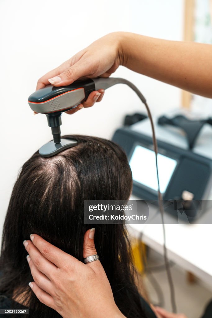 Revitalizing Alopecia Treatment: Woman's Head Under Radiofrequency Therapy at Hair Clinic