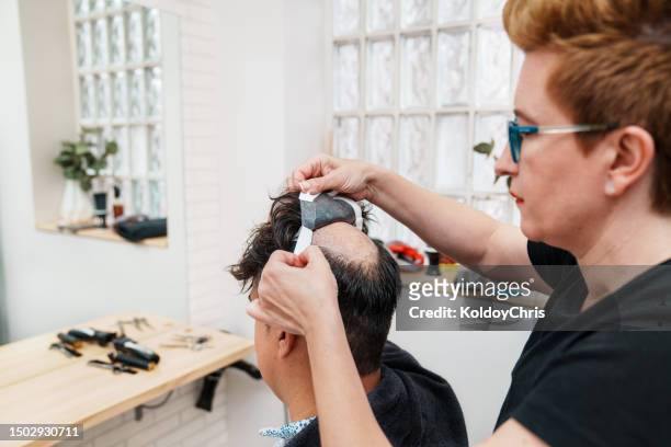 peg-sticker hair restoration: skilled stylist assists balding man with alopecia using adhesive patches at a hair clinic. - alongamento de cabelo - fotografias e filmes do acervo
