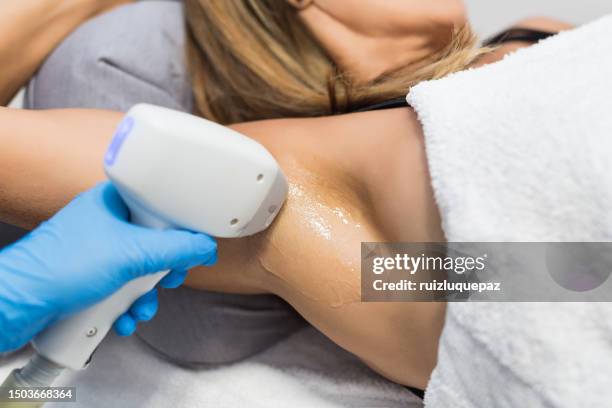 armpit laser hair removal process - laser stockfoto's en -beelden