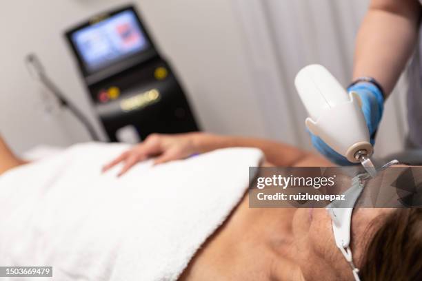 laser hair removal process - electrolysis stock pictures, royalty-free photos & images