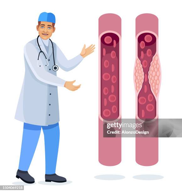 doctor checking blood vein on cholesterol. blood vessels. - ldl cholesterol stock illustrations