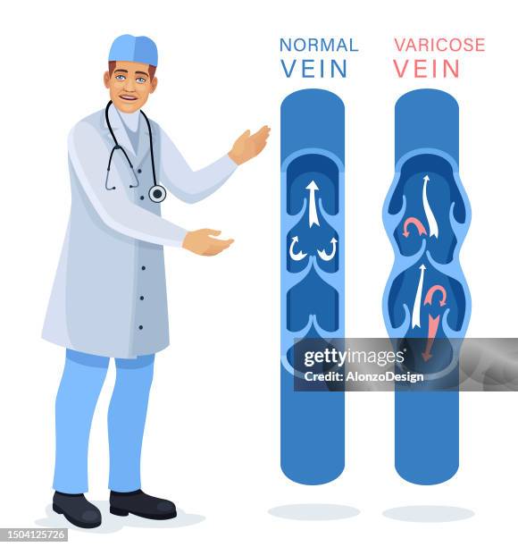 ärztliche untersuchung und diagnose von erkrankungen der blutgefäße und venen. behandlung von krampfadern. - krampfader stock-grafiken, -clipart, -cartoons und -symbole