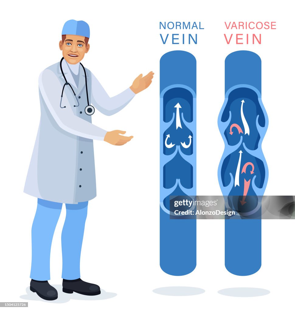 Doctor examining and diagnosis Blood Vessels and Veins Diseases. Varicose Veins Treatment.