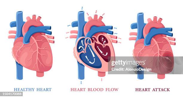 stockillustraties, clipart, cartoons en iconen met healthy heart. heart blood flow. heart attack. human heart anatomy. - coronary arteries diagram