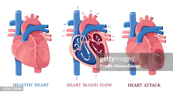 Healthy Heart. Heart Blood Flow. Heart Attack. Human Heart Anatomy. Healthy Heart. Heart Blood Flow. Heart Attack. Human Heart Anatomy.