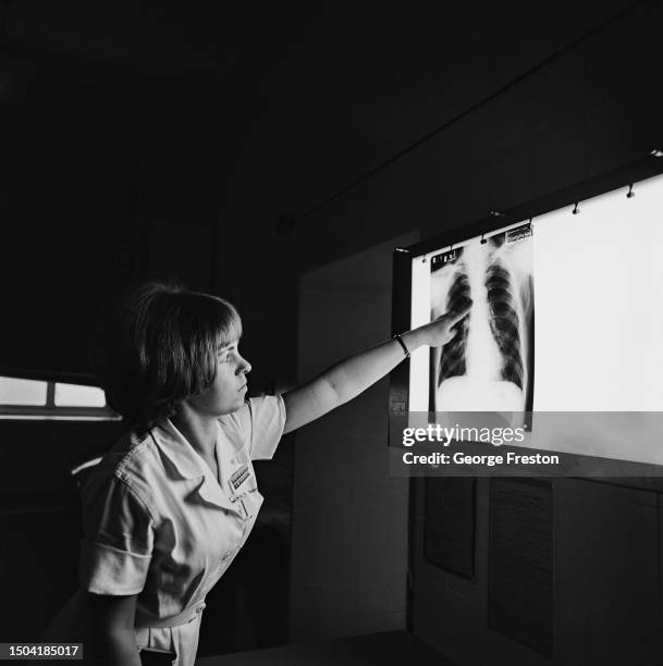 Student radiographer points to an x-ray image in the Diagnostic X-Ray Department of St Bartholomew's Hospital, London, February 1968.