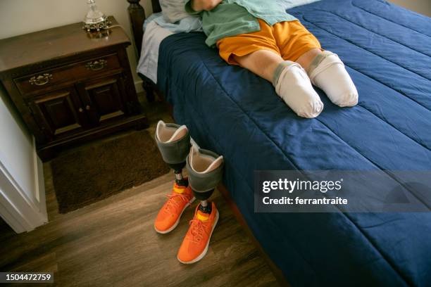 senior man with leg amputations sleeping - diabetic amputation stock pictures, royalty-free photos & images