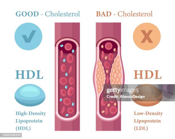 arten von cholesterin im blutkonzept. high-density-lipoprotein (hdl) und low-density-lipoprotein (ldl). - atherosklerose stock-grafiken, -clipart, -cartoons und -symbole