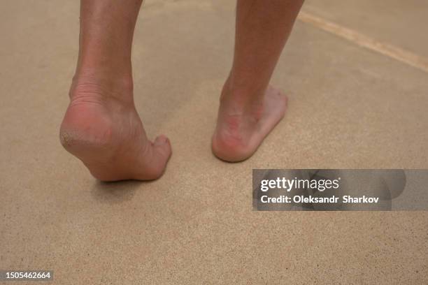 cracked heel treatment the foot - images of ugly feet stock pictures, royalty-free photos & images