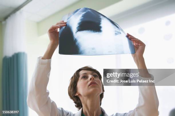 caucasian doctor looking at x-ray - scientific imaging technique stock pictures, royalty-free photos & images