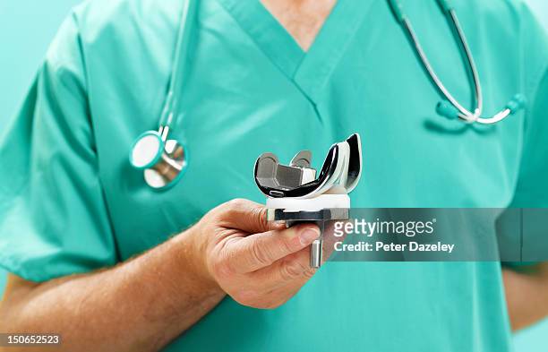 orthopedic surgeon with replacement knee - knee replacement surgery stock-fotos und bilder