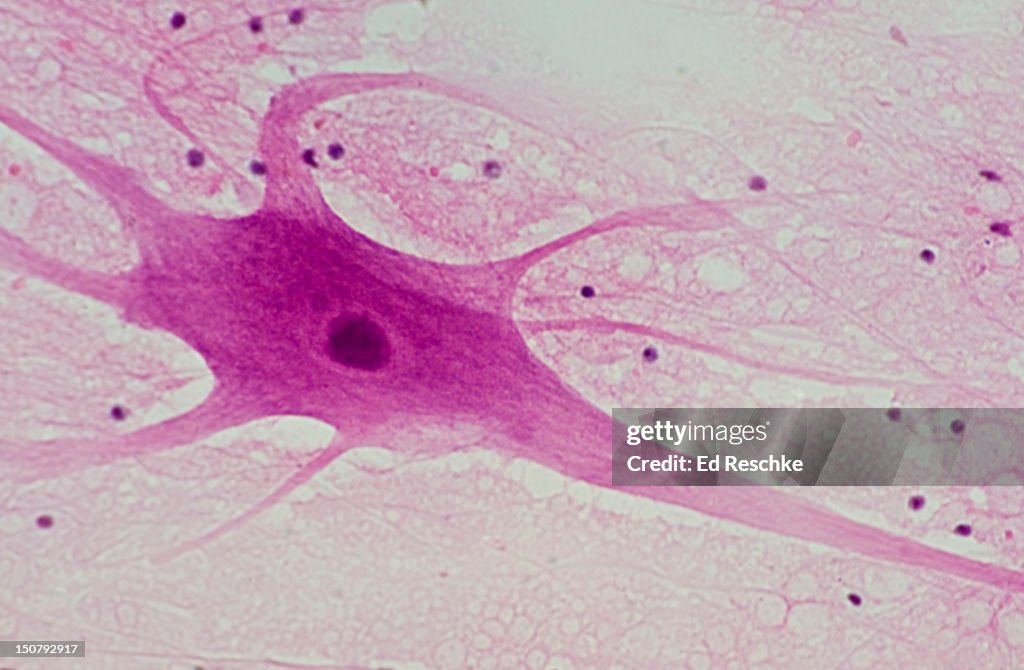 Multipolar Neuron Cell Body Dendrites High-Res Stock Photo - Getty Images