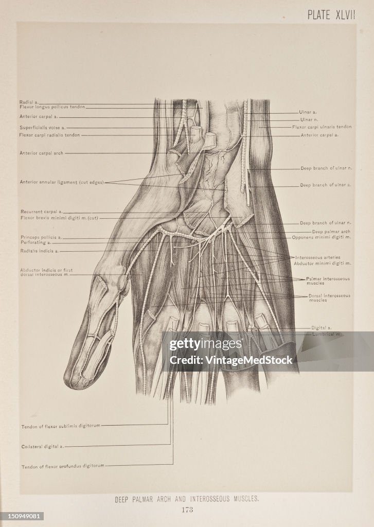 Deep Palmar Arch & Interosseous Muscles