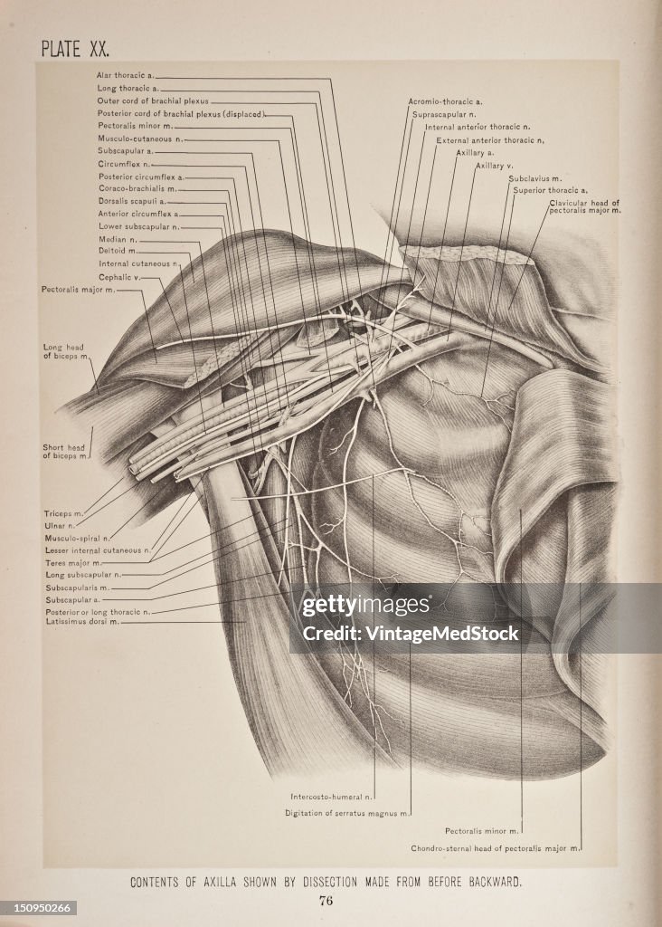 Contents Of Axilla Shown By Dissection Made From Before Backward