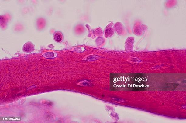 intramembranous ossification, membrane bone - osteocyte stock pictures, royalty-free photos & images