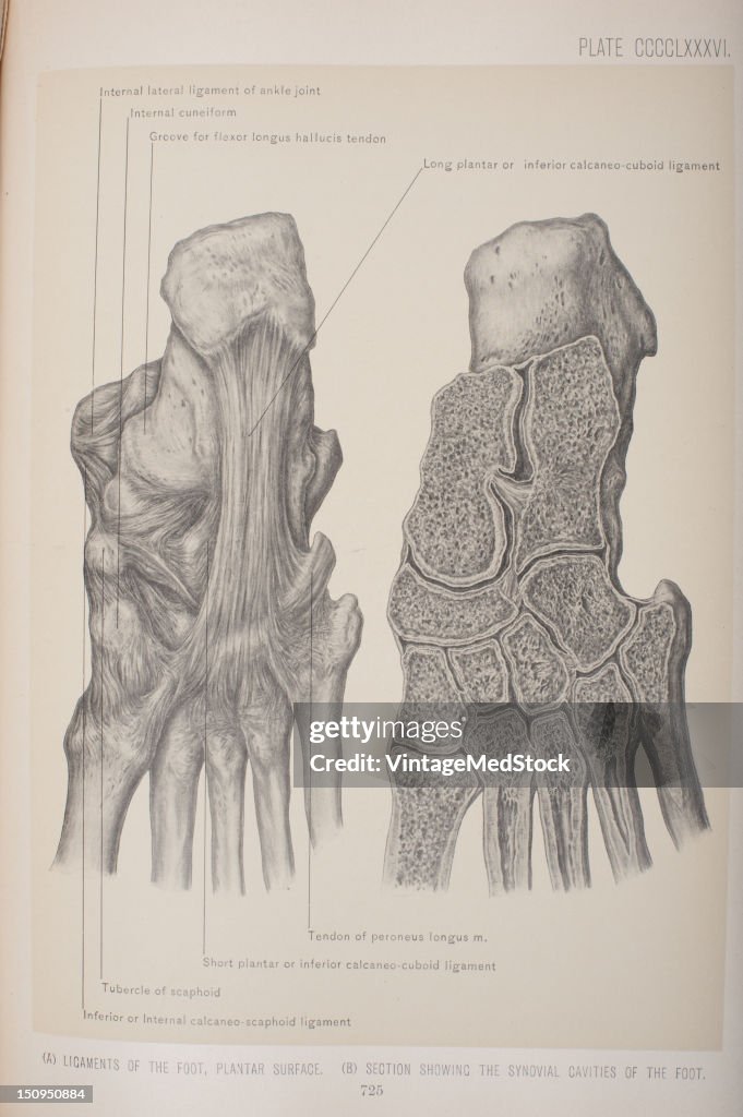 (A) Ligament Of The Foot- Plantar Surface (B)Section Showing The Synovial Cavities Of The Foot