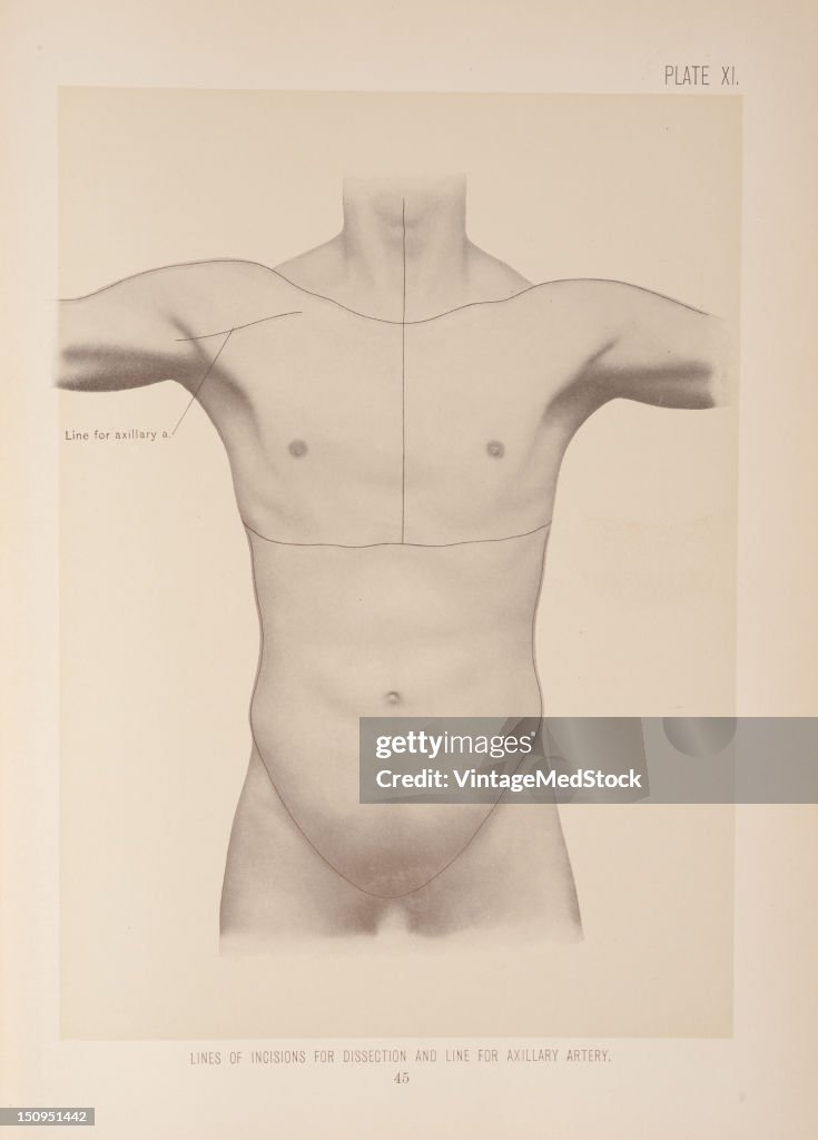 Axillary Incision Types The course of the axillary artery, with the arm at a right angle to ...
