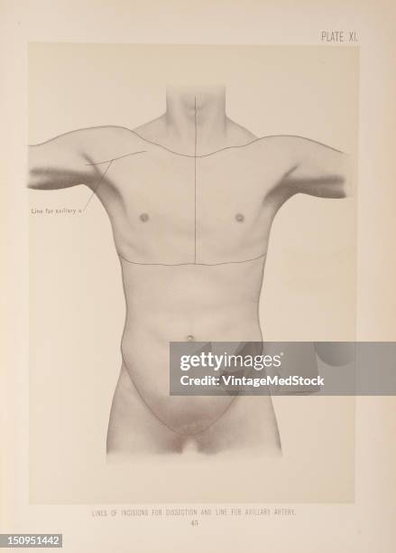 Left Axillary Incision The course of the axillary artery, with the arm at a right angle to ...